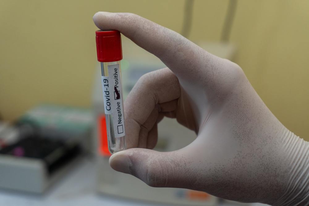 Empty blood tube with Positive Coronavirus label by Prasesh Shiwakoti
